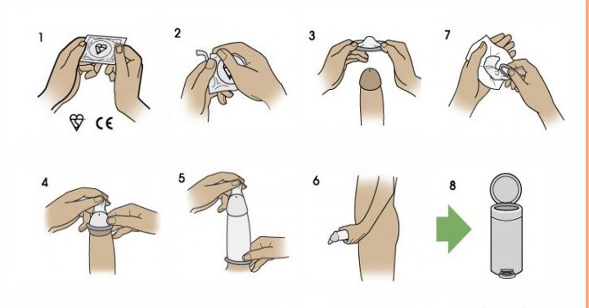 Bao cao su Bao cao su