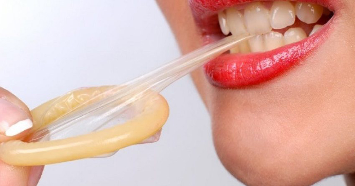 Bao cao su Bao cao su